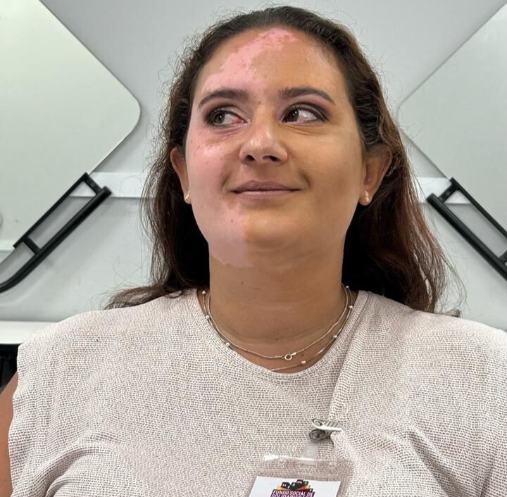 Dia da Mulher: em curso de maquiagem, aluna do Funss ressignifica relação com vitiligo
